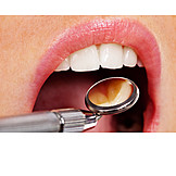   Zahnbehandlung, Zahnarzt, Zahnarztbesuch, Mundspiegel